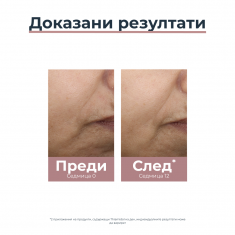 Eucerin Anti-Pigment SPF30 Дневен крем против тъмни петна - тъмен 50 ml