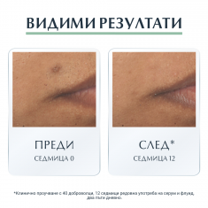 Eucerin DermoPure Серум с тройно действие 40 ml