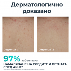 Eucerin® DERMOPURE CLINICAL Коригиращ крем за тяло 200 ml