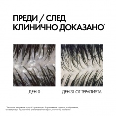 Vichy Dercos Шампоан + Балсам 2 в 1 против пърхот 200 ml
