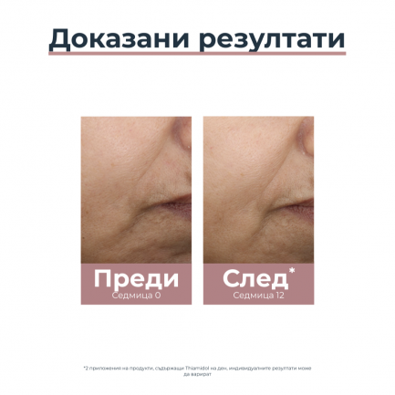 Eucerin Anti-Pigment SPF30 Дневен крем против тъмни петна - светъл 50 ml