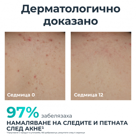 Eucerin® DERMOPURE CLINICAL Коригиращ крем за тяло 200 ml