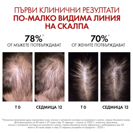 Vichy Dercos Aminexil Clinical R.E.G.E.N. Booster Серум за обновяване на косата 90 ml